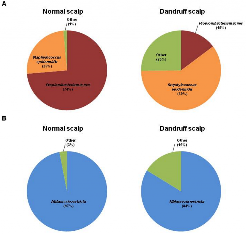 Pie charts of the bacterial and fungal communities of dandruff and healthy scalps.